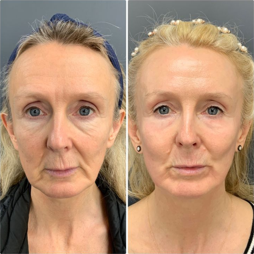 Review by Margaret T.