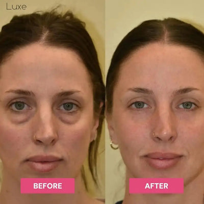 Luxe | Korean Under-Eye Balm Luxe Research