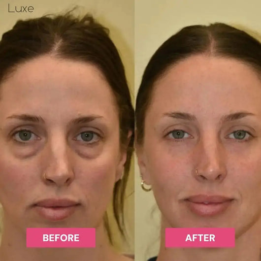 Luxe | Korean Under-Eye Balm Luxe Research